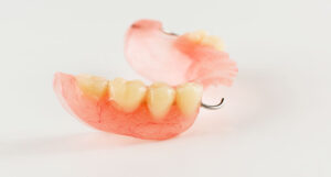 Partial denture with a stainless steel clasp