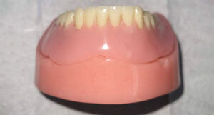 Picture of a new lower denture